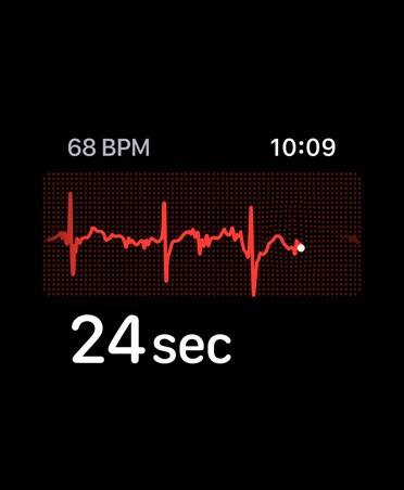 Appen EKG, slag per minut i övre högra hörnet, EKG-kurva, timer